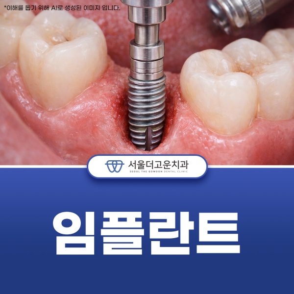 3. 임플란트.jpg